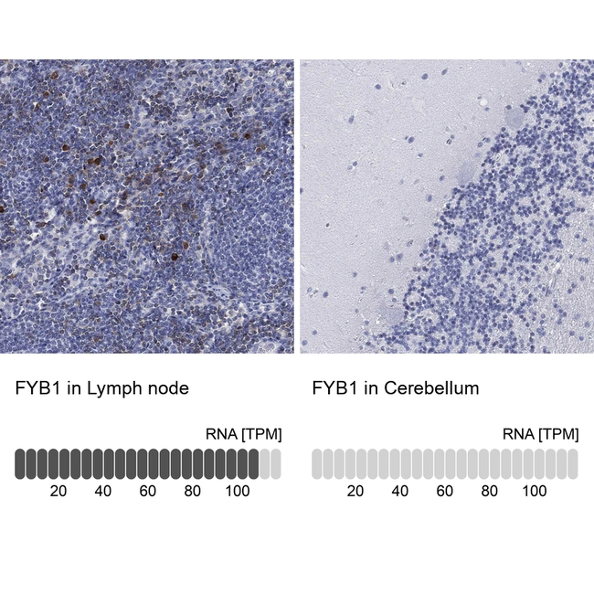 ADAP Antibody in Immunohistochemistry (Paraffin) (IHC (P))