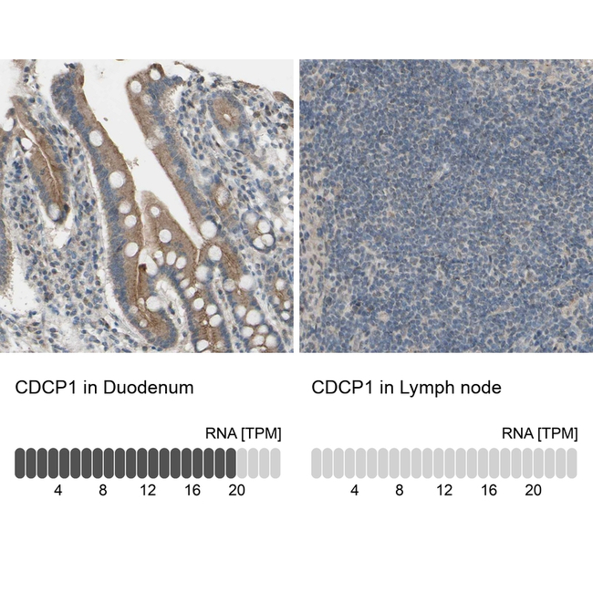 CDCP1 Antibody in Immunohistochemistry (Paraffin) (IHC (P))