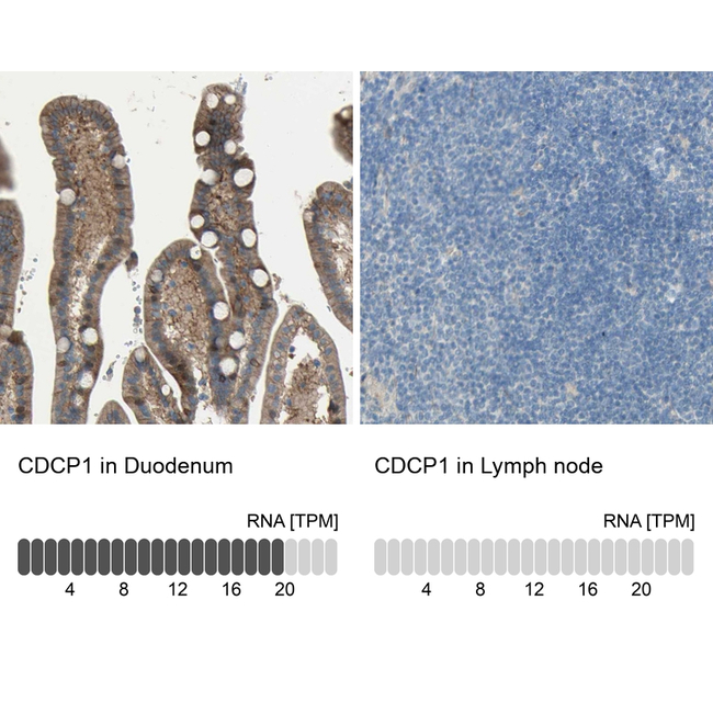 CDCP1 Antibody in Immunohistochemistry (Paraffin) (IHC (P))