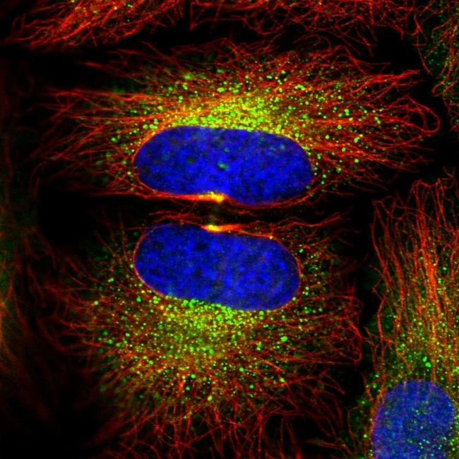 PSMB8 Antibody in Immunocytochemistry (ICC/IF)