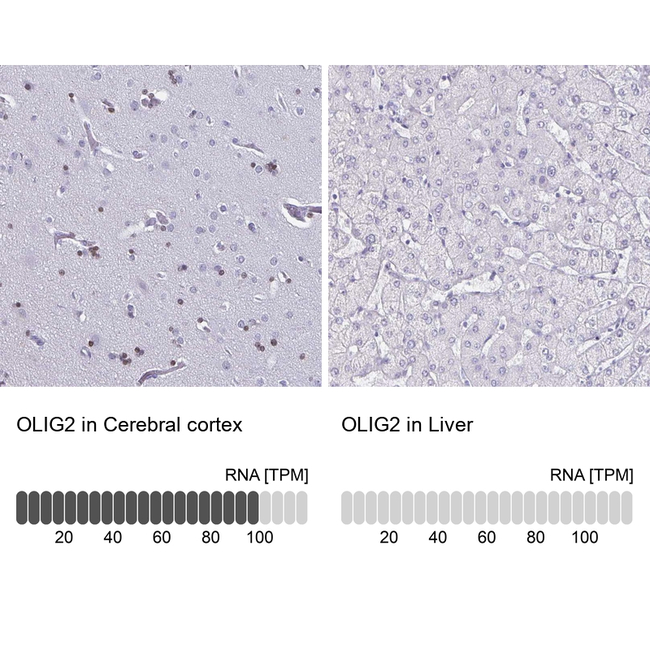 OLIG2 Antibody in Immunohistochemistry (Paraffin) (IHC (P))