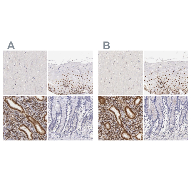 Estrogen Receptor alpha Antibody in Immunohistochemistry (Paraffin) (IHC (P))