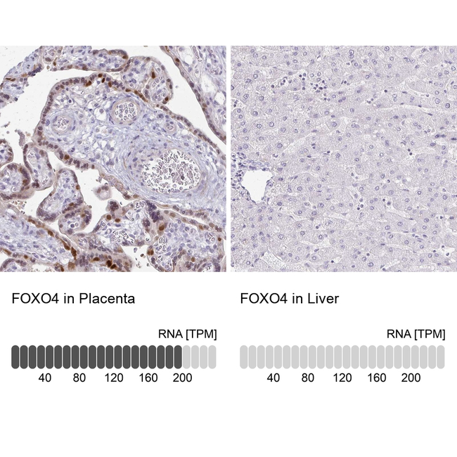 FOXO4 Antibody in Immunohistochemistry (Paraffin) (IHC (P))
