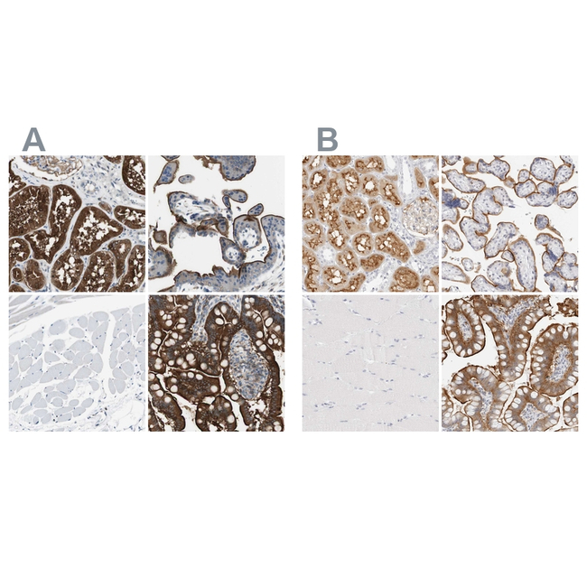 EBP50 Antibody in Immunohistochemistry (Paraffin) (IHC (P))