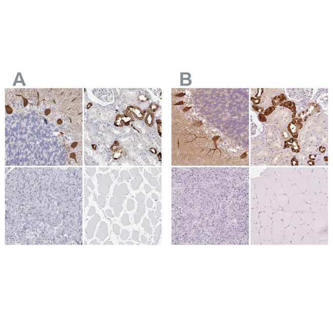 Calbindin D28K Antibody in Immunohistochemistry (Paraffin) (IHC (P))