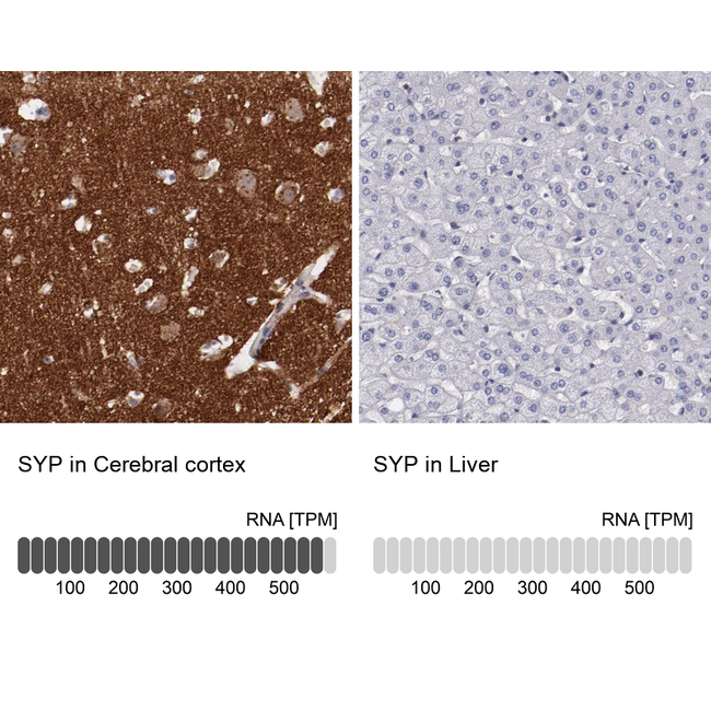 Synaptophysin Antibody in Immunohistochemistry (Paraffin) (IHC (P))