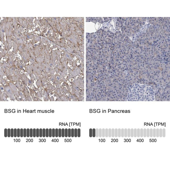 CD147 Antibody in Immunohistochemistry (Paraffin) (IHC (P))