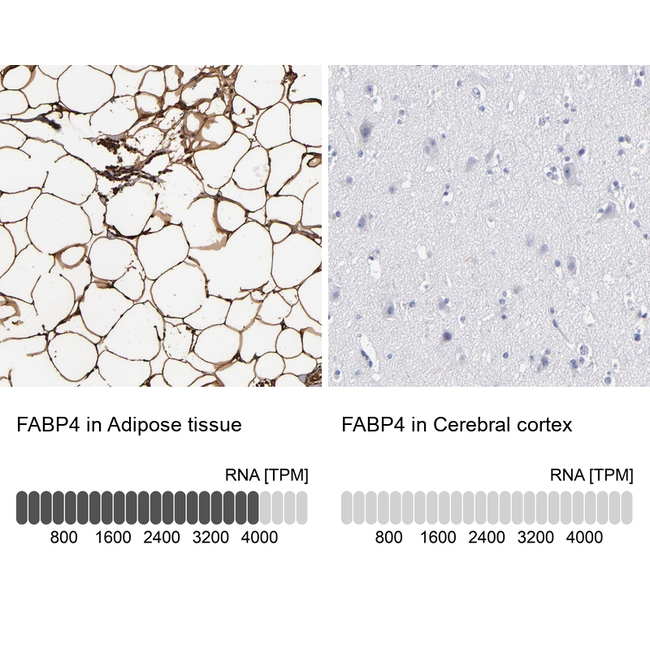 FABP4 Antibody in Immunohistochemistry (Paraffin) (IHC (P))