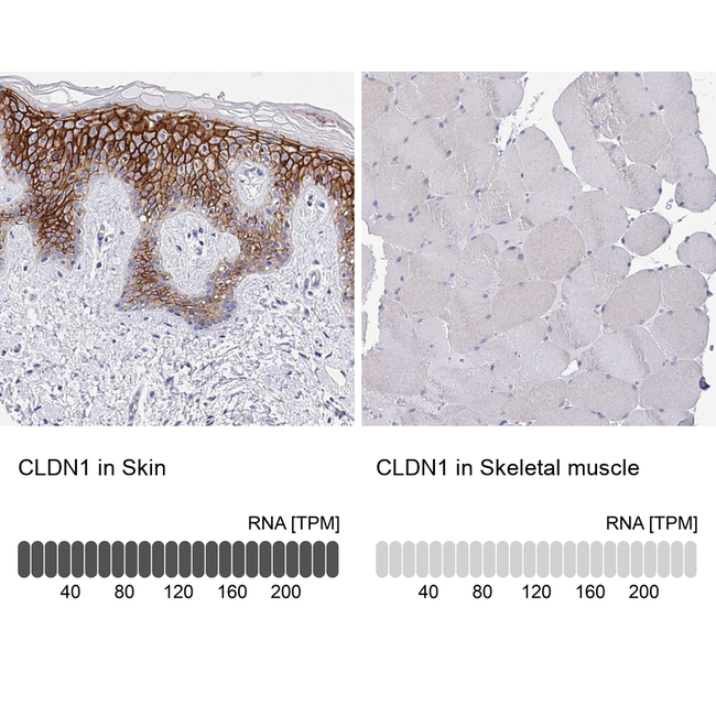 Claudin 1 Antibody in Immunohistochemistry (Paraffin) (IHC (P))
