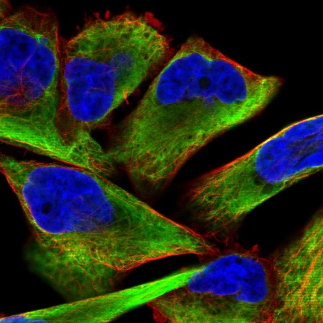 Desmin Antibody in Immunocytochemistry (ICC/IF)