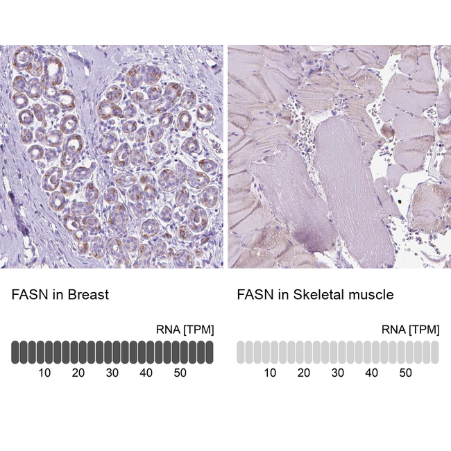 FASN Antibody in Immunohistochemistry (Paraffin) (IHC (P))