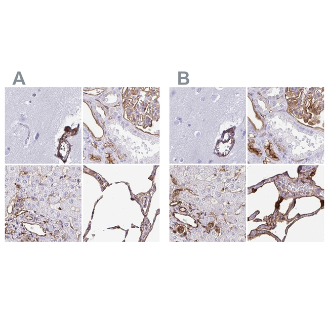 Annexin A2 Antibody in Immunohistochemistry (Paraffin) (IHC (P))