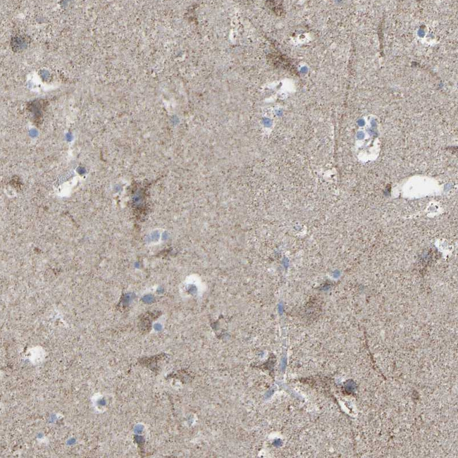 BCL-10 Antibody in Immunohistochemistry (Paraffin) (IHC (P))