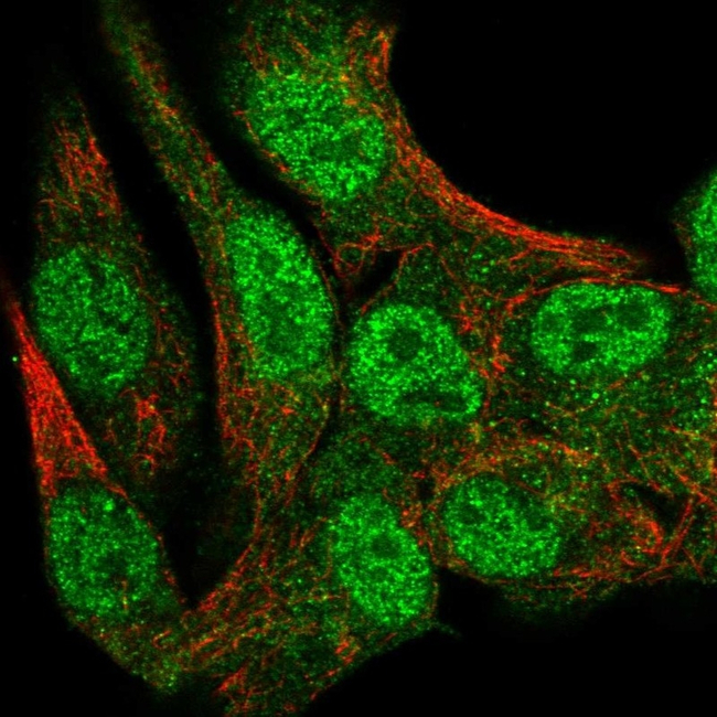 MUNC18 Antibody in Immunocytochemistry (ICC/IF)