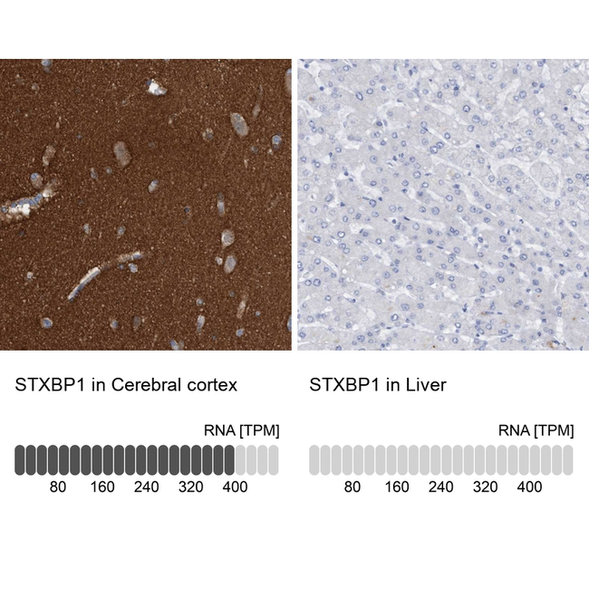 MUNC18 Antibody in Immunohistochemistry (Paraffin) (IHC (P))