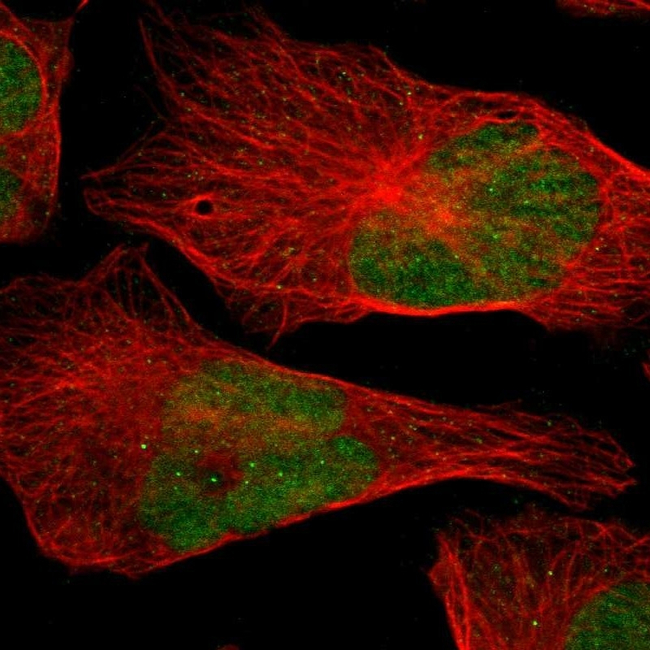 APE1 Antibody in Immunocytochemistry (ICC/IF)