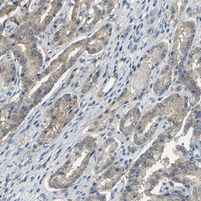 Occludin Antibody in Immunohistochemistry (Paraffin) (IHC (P))