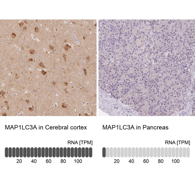 LC3A Antibody in Immunohistochemistry (Paraffin) (IHC (P))