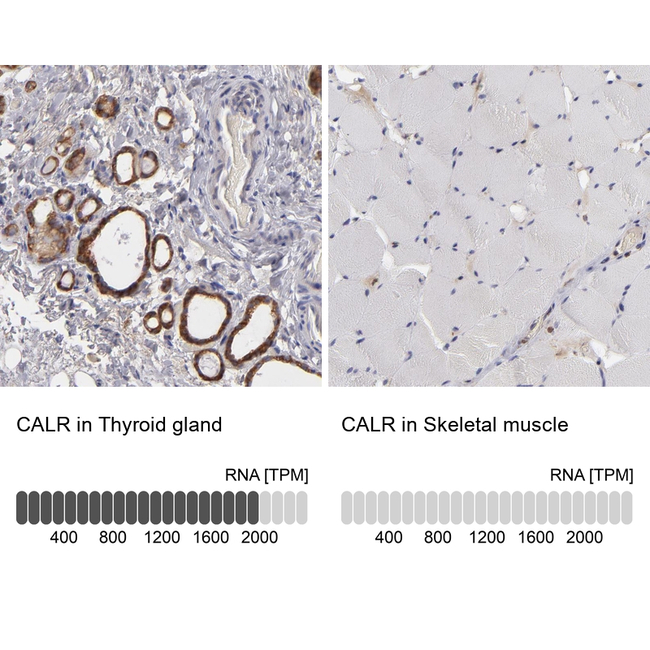 Calreticulin Antibody in Immunohistochemistry (Paraffin) (IHC (P))