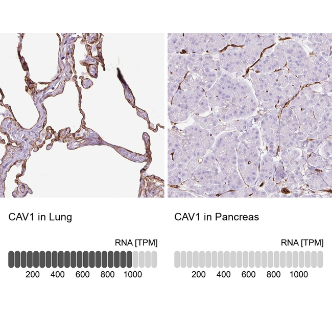 Caveolin 1 Antibody in Immunohistochemistry (Paraffin) (IHC (P))