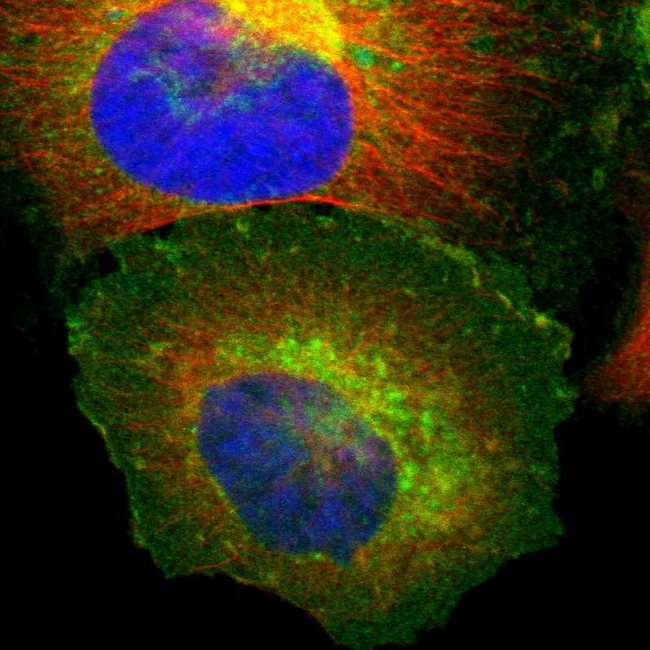 beta-2 Microglobulin Antibody in Immunocytochemistry (ICC/IF)