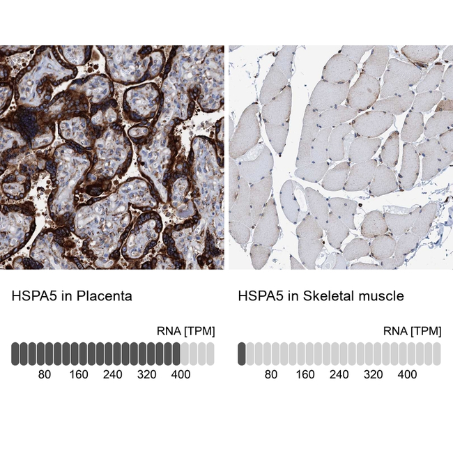 GRP78 Antibody in Immunohistochemistry (Paraffin) (IHC (P))