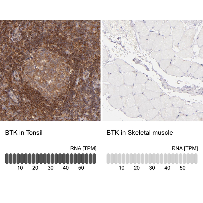 BTK Antibody in Immunohistochemistry (Paraffin) (IHC (P))