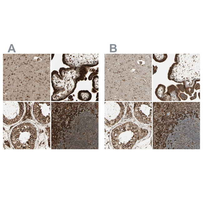 Calnexin Antibody in Immunohistochemistry (Paraffin) (IHC (P))