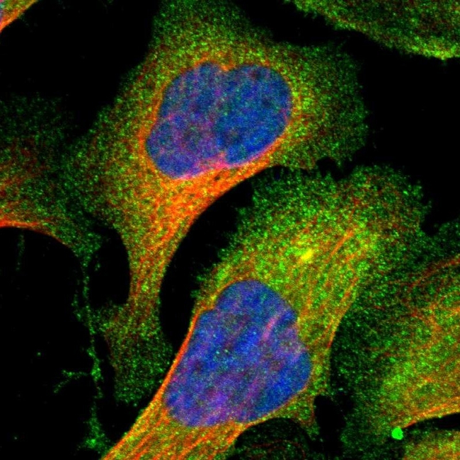 PAK1 Antibody in Immunocytochemistry (ICC/IF)