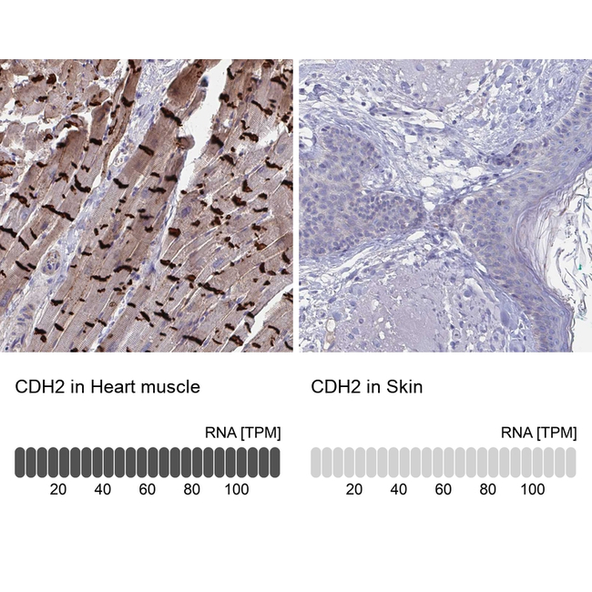 N-cadherin Antibody in Immunohistochemistry (Paraffin) (IHC (P))