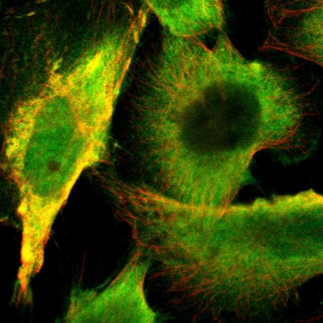 PGP9.5 Antibody in Immunocytochemistry (ICC/IF)