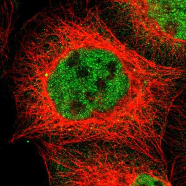 Glucocorticoid Receptor Antibody in Immunocytochemistry (ICC/IF)