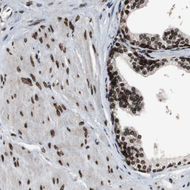 Lamin A/C Antibody in Immunohistochemistry (Paraffin) (IHC (P))