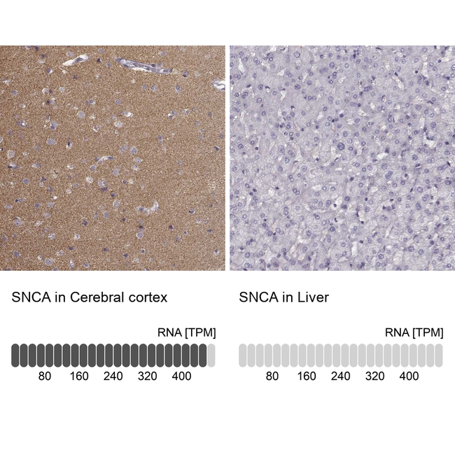 alpha Synuclein Antibody in Immunohistochemistry (Paraffin) (IHC (P))