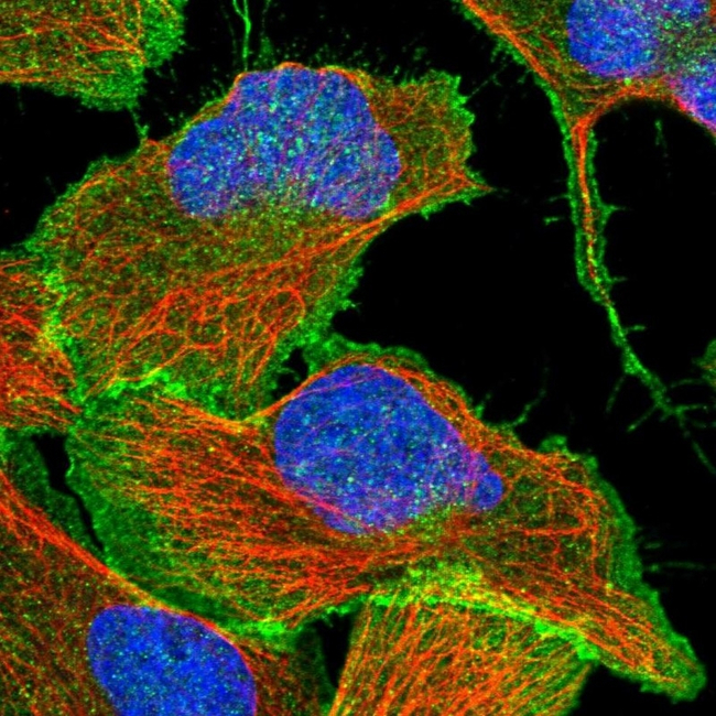 beta Catenin Antibody in Immunocytochemistry (ICC/IF)