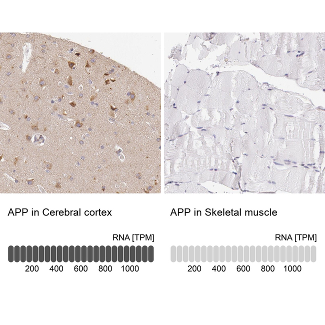 Amyloid Precursor Protein Antibody in Immunohistochemistry (Paraffin) (IHC (P))