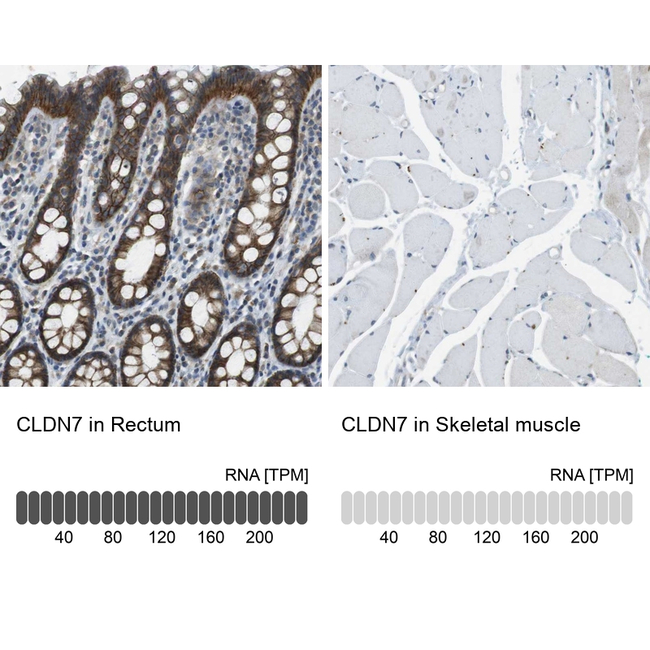Claudin 7 Antibody in Immunohistochemistry (Paraffin) (IHC (P))