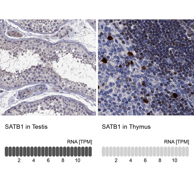 SATB1 Antibody in Immunohistochemistry (Paraffin) (IHC (P))