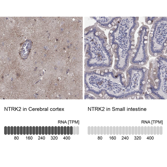 TrkB Antibody in Immunohistochemistry (Paraffin) (IHC (P))