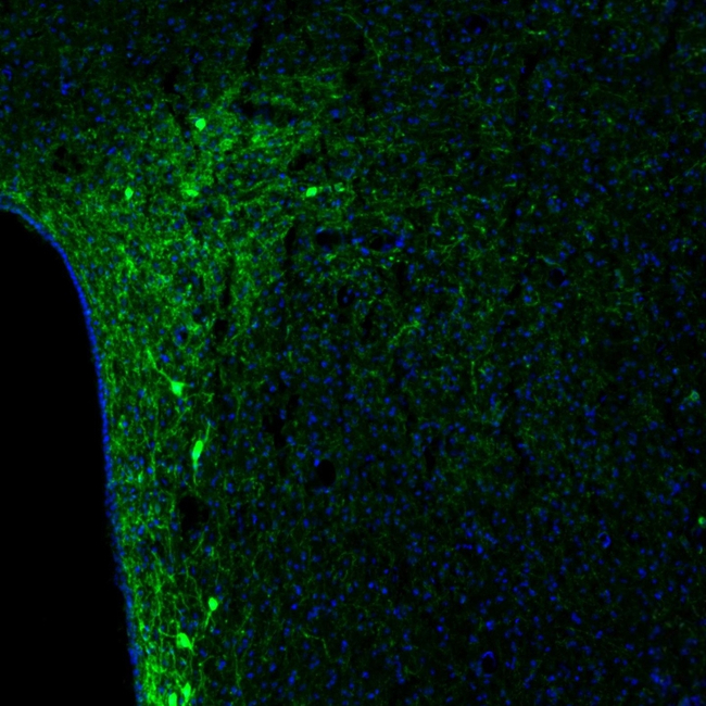 Tyrosine Hydroxylase Antibody in Immunohistochemistry (Paraffin) (IHC (P))