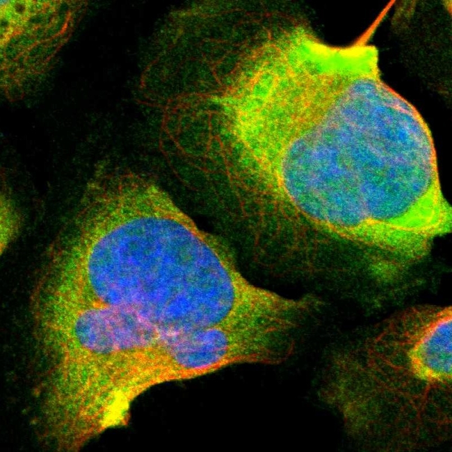 Calretinin Antibody in Immunocytochemistry (ICC/IF)