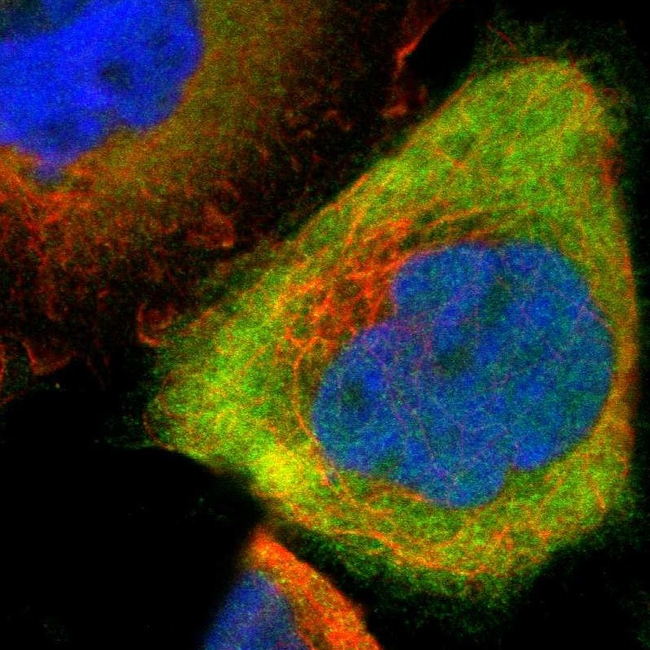 Calretinin Antibody in Immunocytochemistry (ICC/IF)