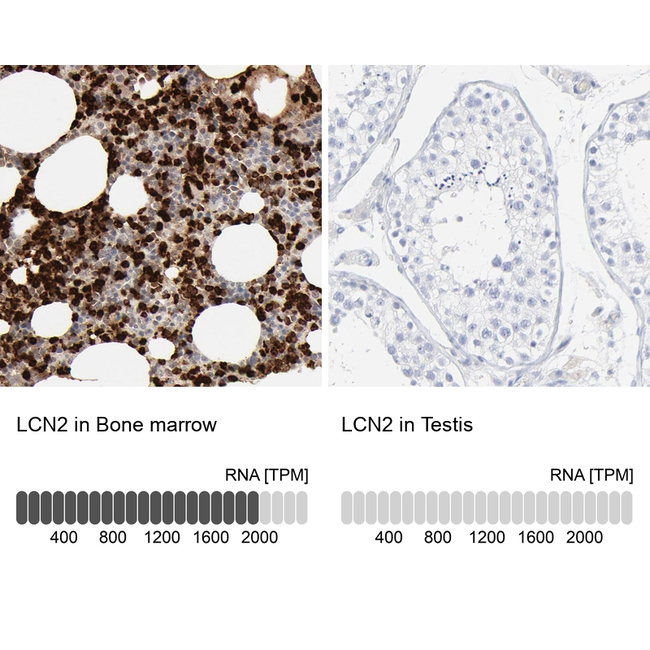 NGAL Antibody in Immunohistochemistry (Paraffin) (IHC (P))
