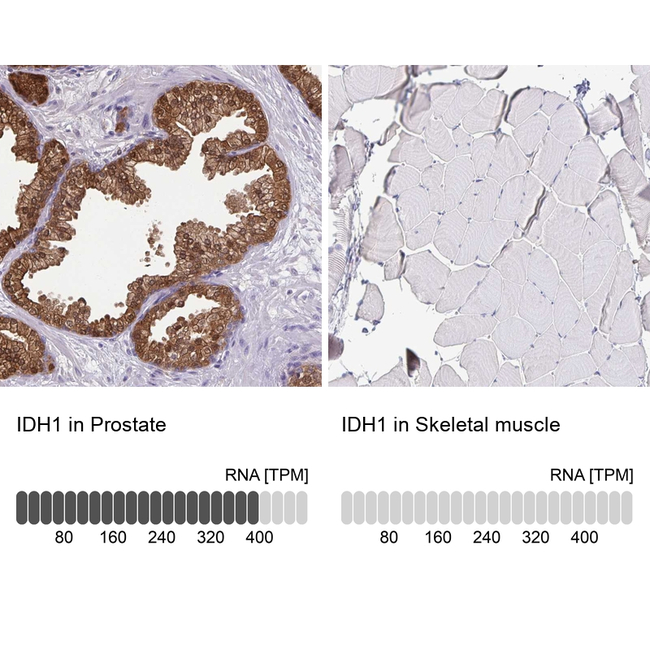 IDH1 Antibody in Immunohistochemistry (Paraffin) (IHC (P))