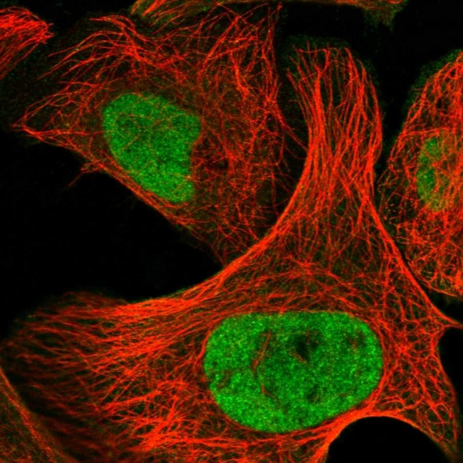 HDAC1 Antibody in Immunocytochemistry (ICC/IF)
