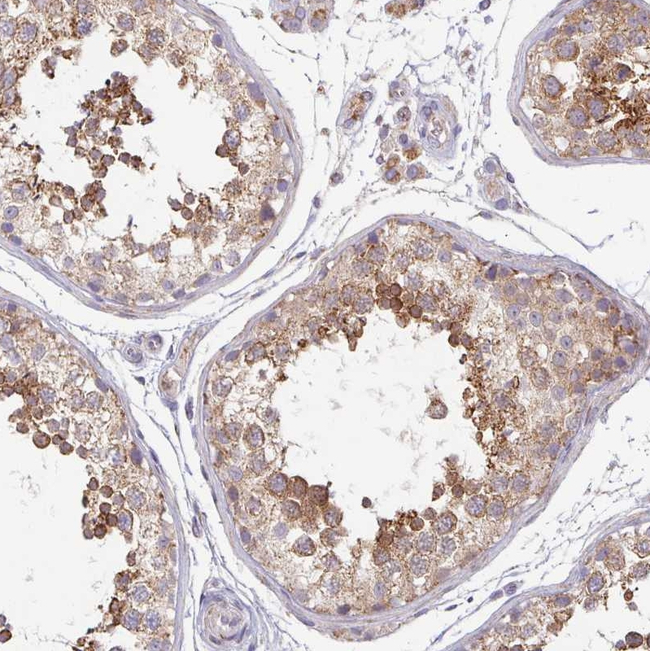 SKP2 Antibody in Immunohistochemistry (Paraffin) (IHC (P))