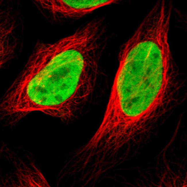 HDAC2 Antibody in Immunocytochemistry (ICC/IF)