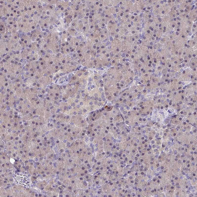 IDH1 Antibody in Immunohistochemistry (Paraffin) (IHC (P))