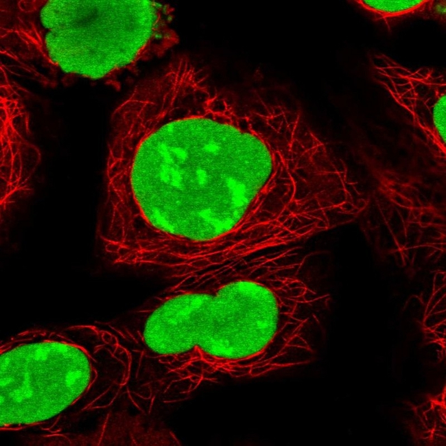 PARP1 Antibody in Immunocytochemistry (ICC/IF)