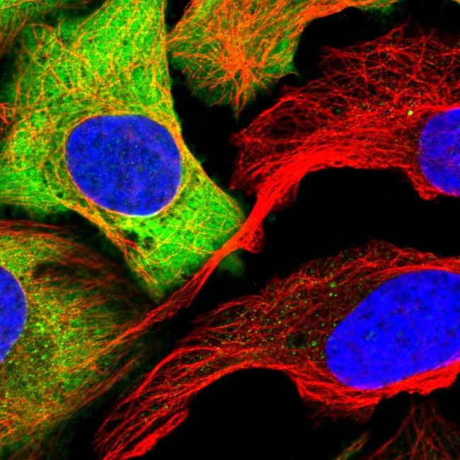 PKM2 Antibody in Immunocytochemistry (ICC/IF)
